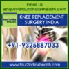 Cost of Knee Replacement Surgery India